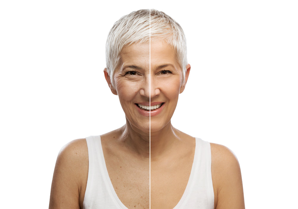 The Benefits of Collagen for Menopause